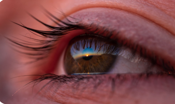 Vision
